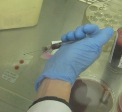 blood culture stain preparation