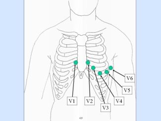 precordial_leads