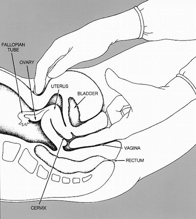 pelvic_exam