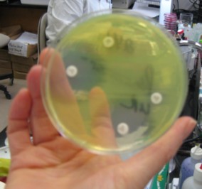 pseudomonas sensitivity testing