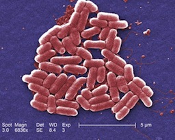 e coli