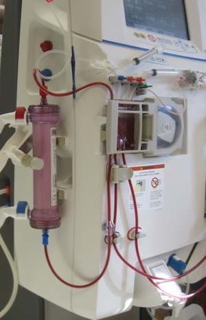 hemodialysis